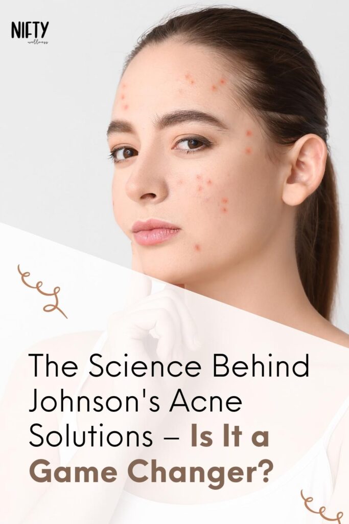The Science Behind Johnson's Acne Solutions – Is It a Game Changer?
