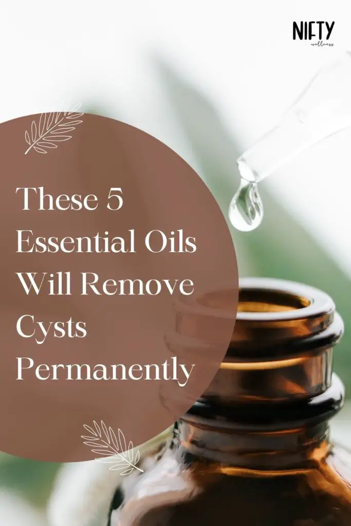 These 5 Essential Oils Will Remove Cysts Permanently 