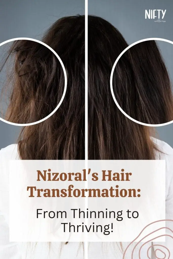 Nizoral's Hair Transformation: From Thinning to Thriving!
