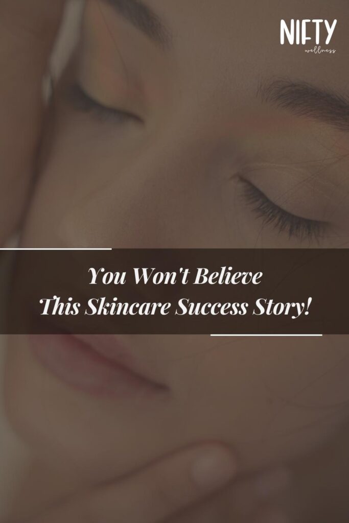 You Won't Believe This Skincare Success Story!