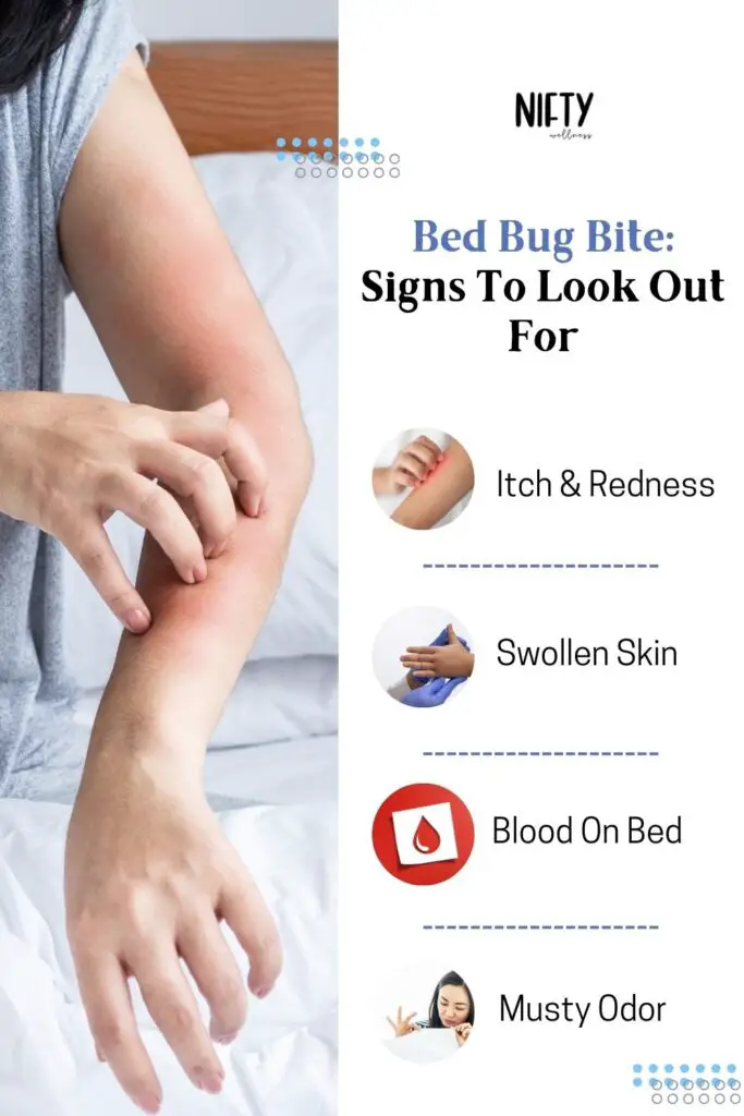 Bed Bug Bite: Signs To Look Out For