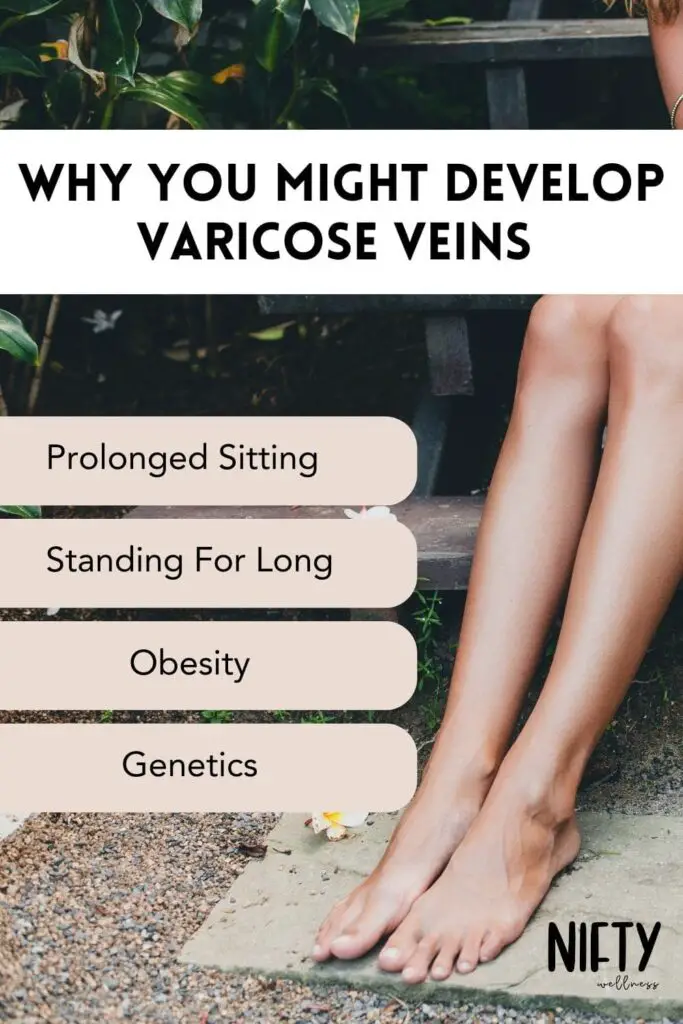 Why You Might Develop Varicose Veins